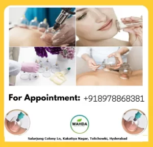Hijama for Ladies in Hyderabad